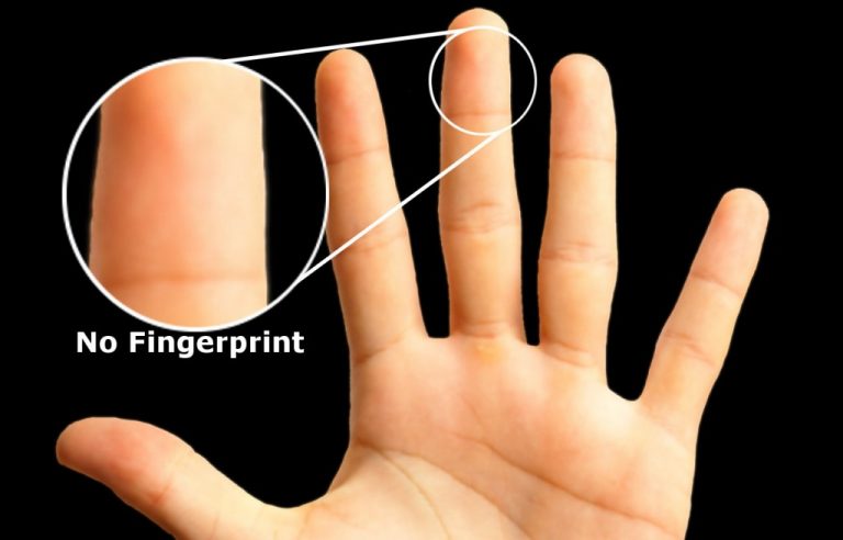 Do Fingerprints Change?