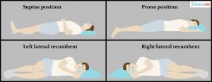 orthopnea recumbent lateral prone dyspnea symptoms causes supine sideways downwards upwards