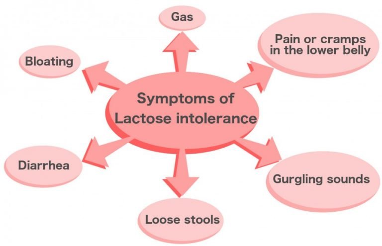 What Is Lactose Intolerance What Are Its Causes Symptoms And Signs