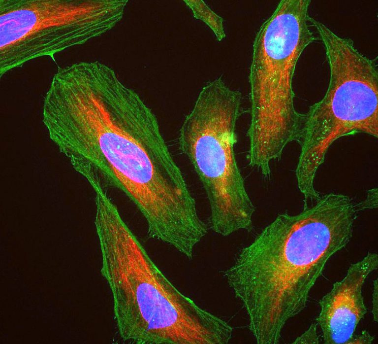 Henrietta Lacks: Who Was She? Why Are HeLa Cells Immortal?