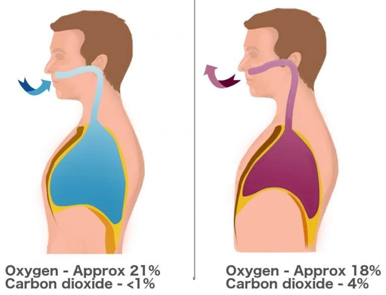 Kiss Of Life: What Is Mouth To Mouth Artificial Respiration? How It Works