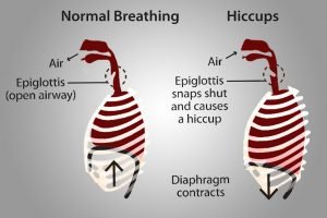 Drunk Hiccups: Why Does Alcohol Cause Hiccups?