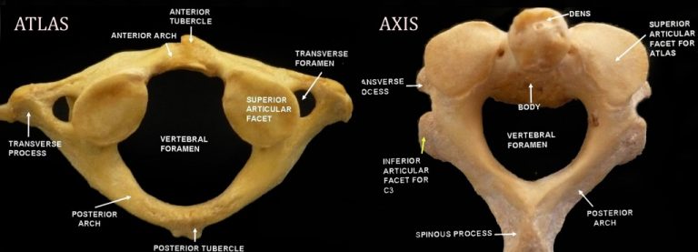 Vertebrae Different Types: Cervical, Thoracic, Lumbar, Sacrococcygeal