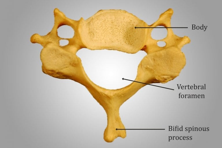 Vertebrae Different Types: Cervical, Thoracic, Lumbar, Sacrococcygeal