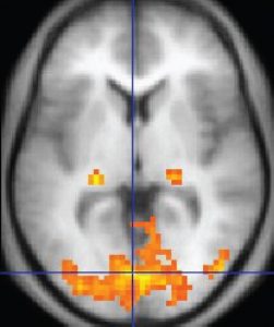 How Do Brain Scans Work? » ScienceABC