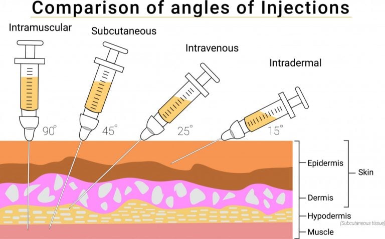 Why Aren’t All Injections Given In The Same Spot? » ScienceABC