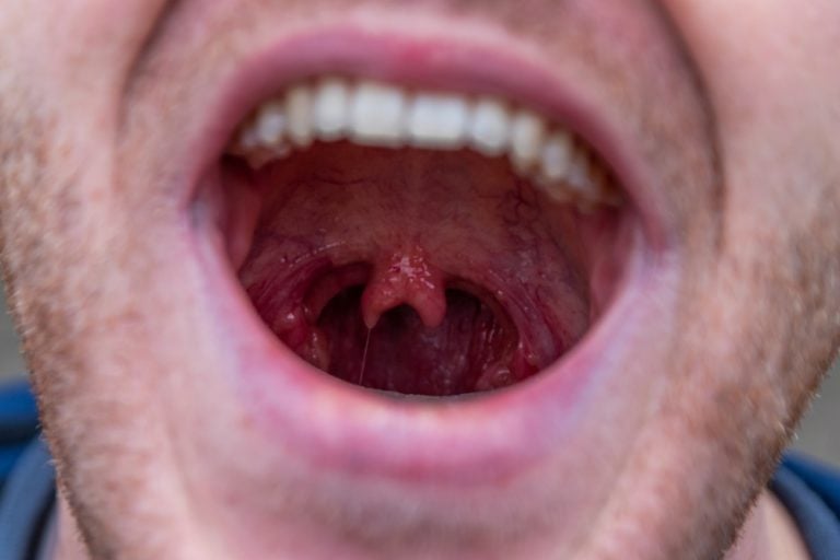 What Does The Uvula Even Do In The Body? » ScienceABC